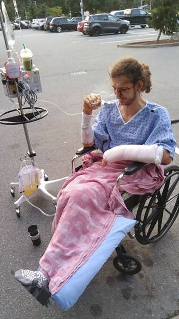Dustin in a hospital gown in a wheelchair outside, with casts on both arms and an IV pole